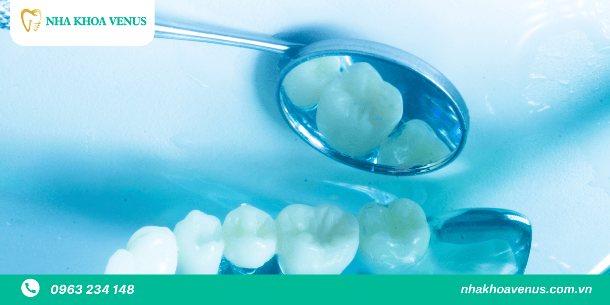 Sau khi nhổ răng bao lâu thì trồng Implant