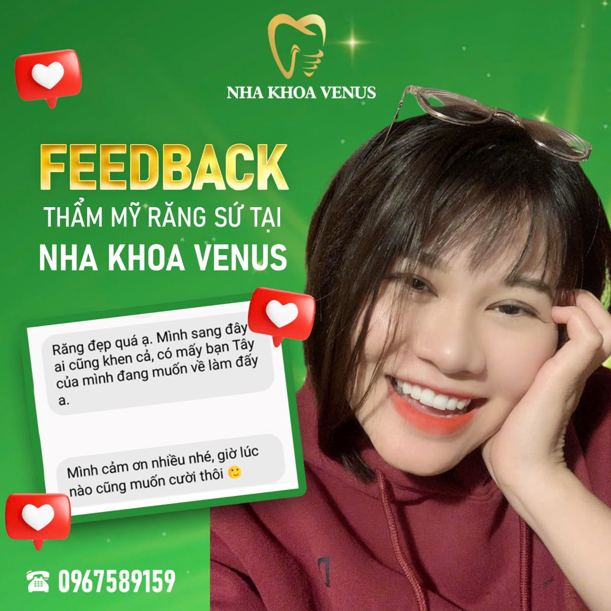 Đánh giá của chị Bảo Ngọc khi niềng răng tại Nha khoa Venus