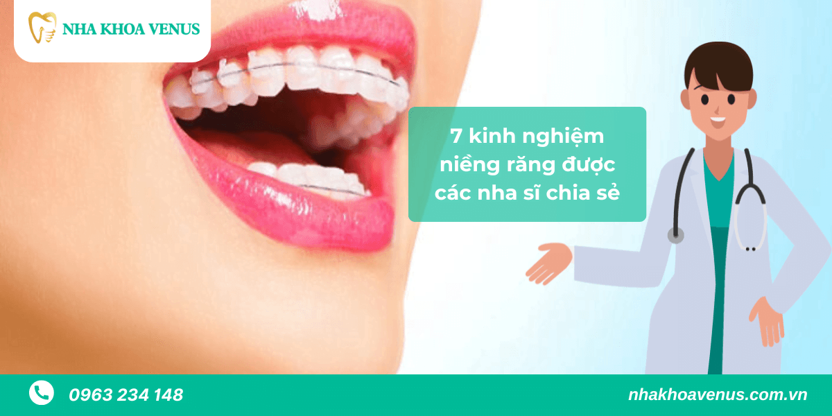 kinh nghiệm niềng răng