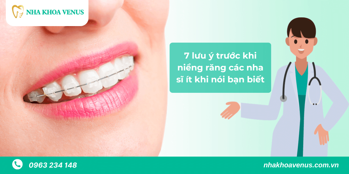 những điều cần biết trước khi niềng răng