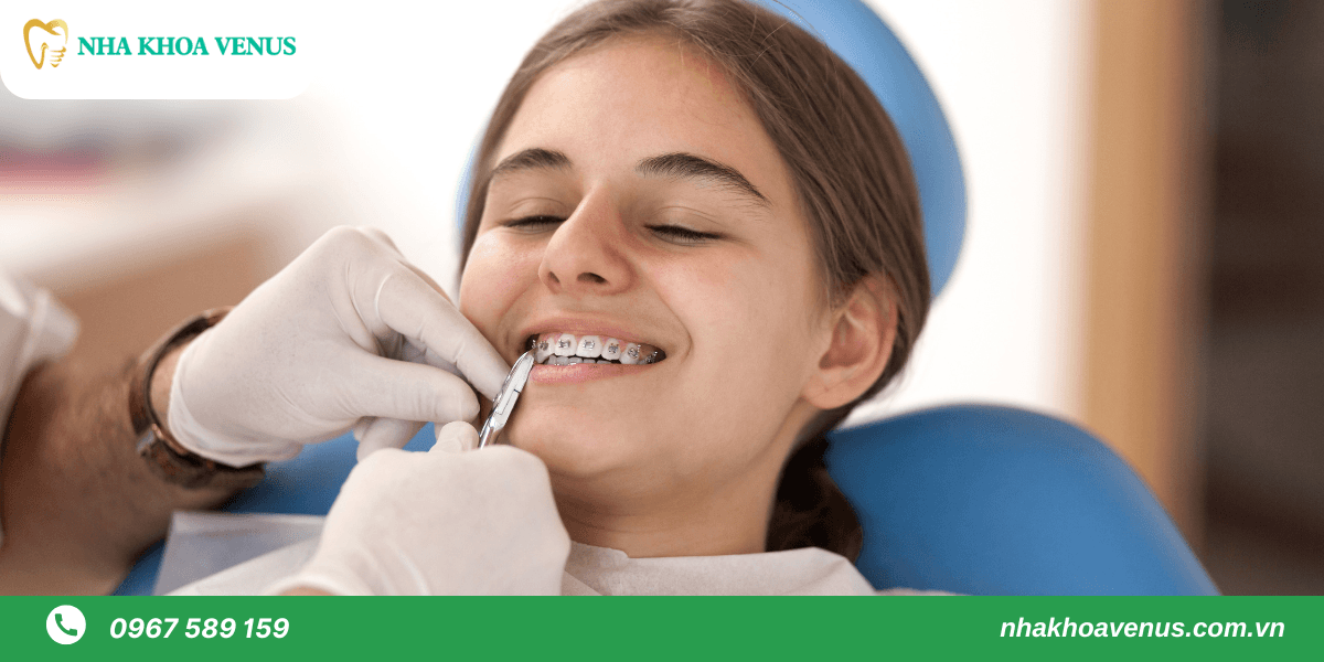 5 giai đoạn niềng răng, chỉnh nha quan trọng và những lưu ý trong các giai đoạn niềng răng bạn phải biết