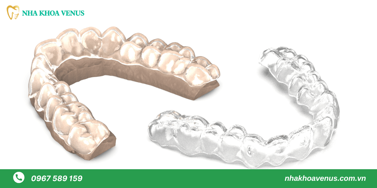 niềng răng không mắc cài 3d clear