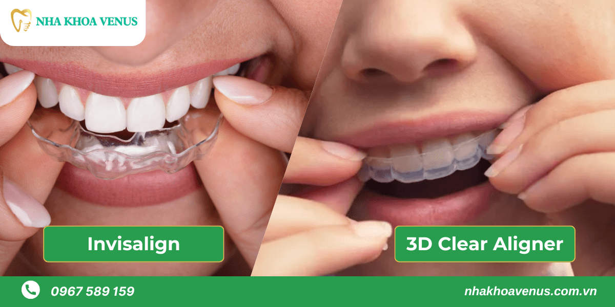 so sánh niềng răng 3d clear và invisalign