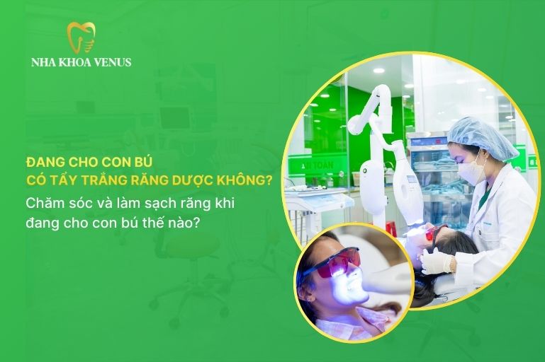 đang cho con bú có tẩy trắng răng được không