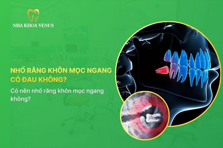 Nhổ răng khôn mọc ngang có đau không
