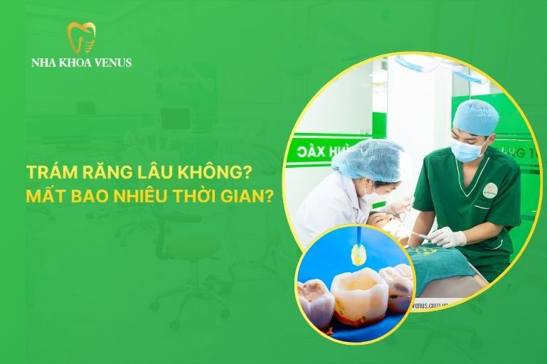 trám răng có lâu không