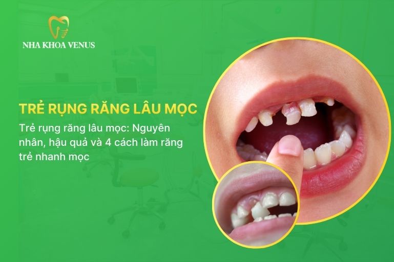 Trẻ rụng răng lâu mọc