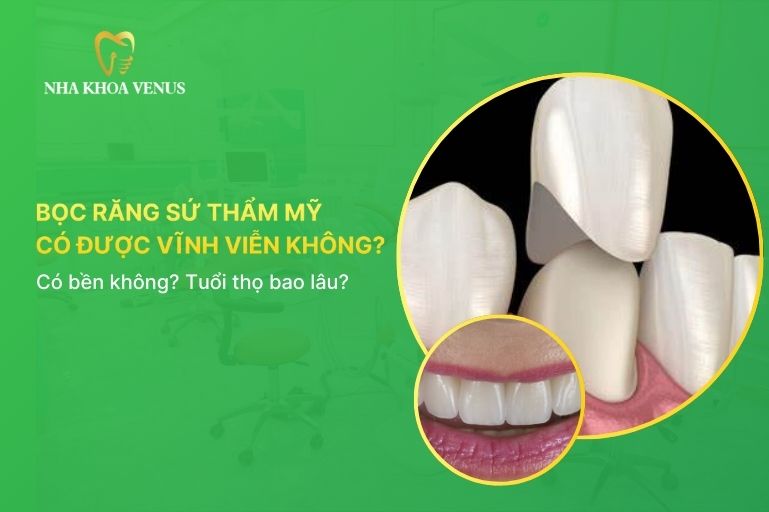 bọc răng sứ vĩnh viễn