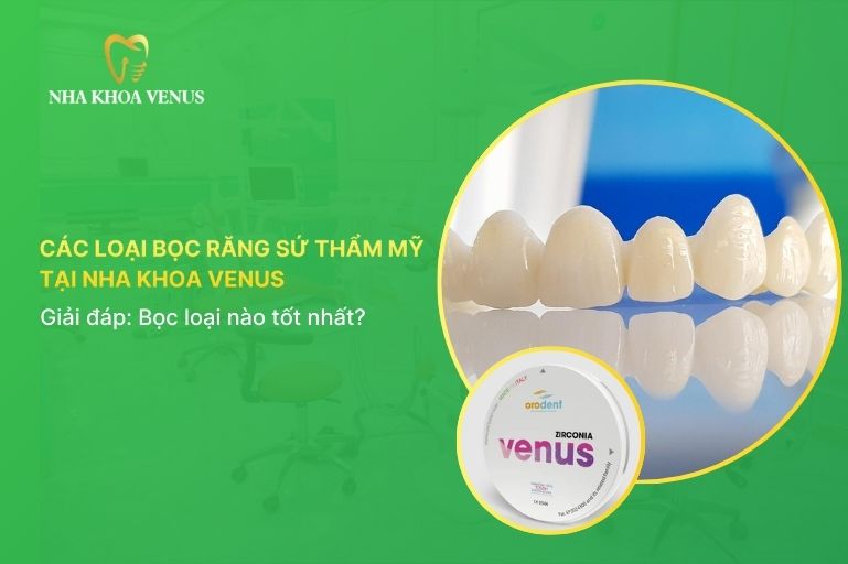 các loại bọc răng sứ thẩm mỹ