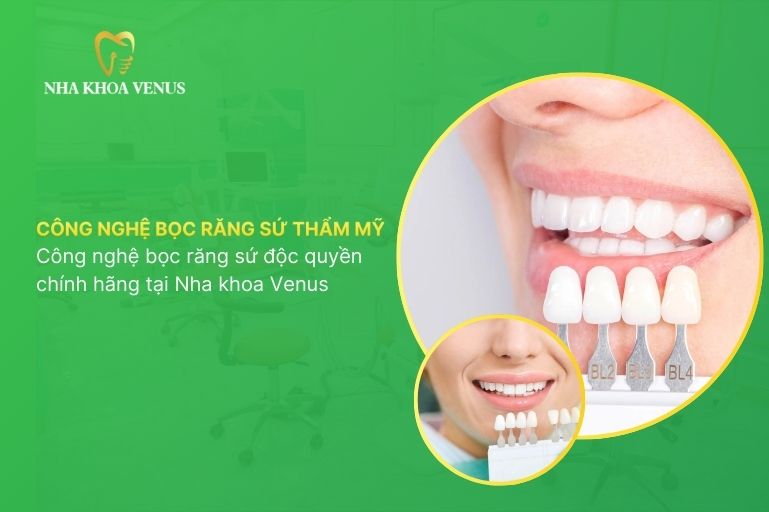 công nghệ bọc răng sứ thẩm mỹ
