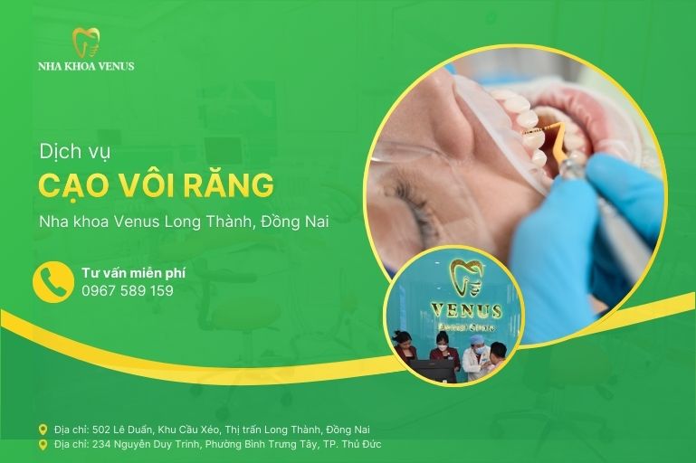 Dịch vụ cạo vôi răng Long Thành, Đồng Nai tại Nha khoa Venus chi nhánh Long Thành, Đồng Nai