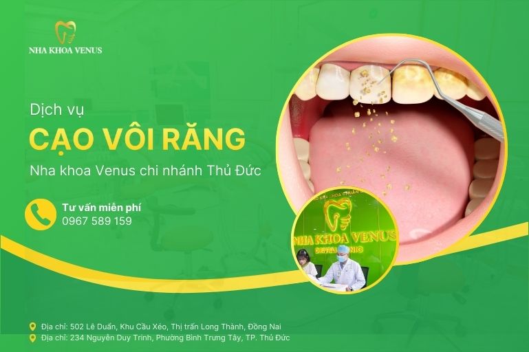 Nha khoa Venus 102 Dịch vụ cạo vôi răng thủ đức tại Nha khoa Venus chi nhánh Thủ Đức