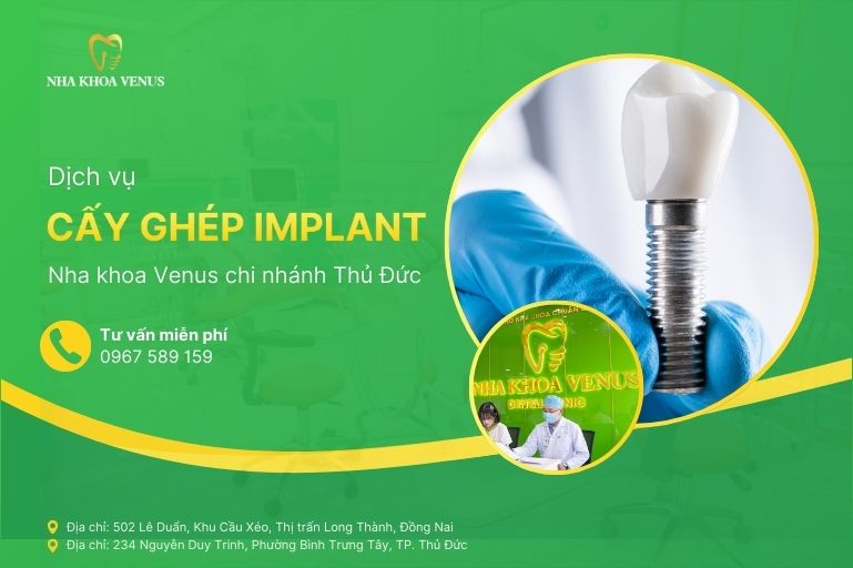 Dịch vụ cấy ghép implant thủ đức tại Nha khoa Venus chi nhánh Thủ Đức
