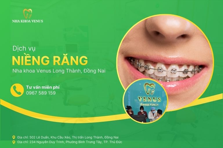 Dịch vụ niềng răng Long Thành, Đồng Nai tại Nha khoa Venus Long Thành Đồng Nai