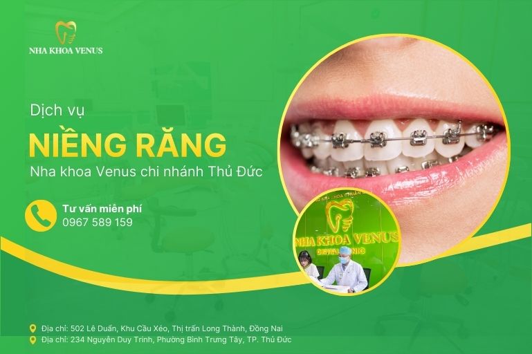 Dịch vụ niềng răng thủ đức tại Nha khoa venus thủ đức