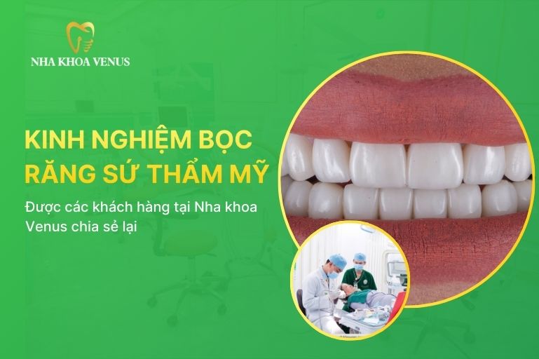 kinh nghiệm bọc răng sứ thẩm mỹ