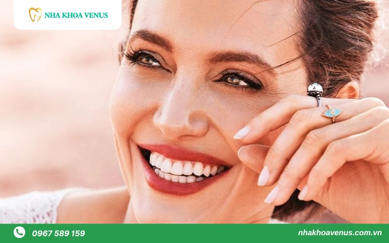 12 Tiêu chí đánh giá của 1 hàm răng đẹp tiêu chuẩn như người mẫu 38 Nụ cười đẹp của Angelina Jolie