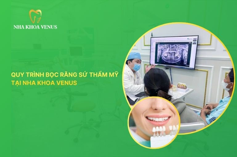 quy trình bọc răng sứ thẩm mỹ