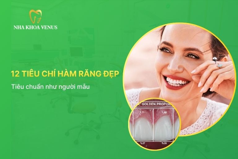 Tiêu chí của 1 hàm răng đẹp tiêu chuẩn