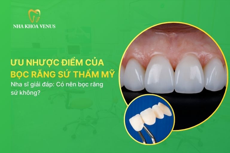 Ưu Nhược Điểm Của Việc Bọc Răng Sứ