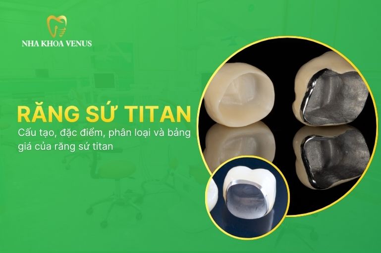 Răng sứ Titan là gì? Cấu tạo, đặc điểm, phân loại và bảng giá của răng sứ titan