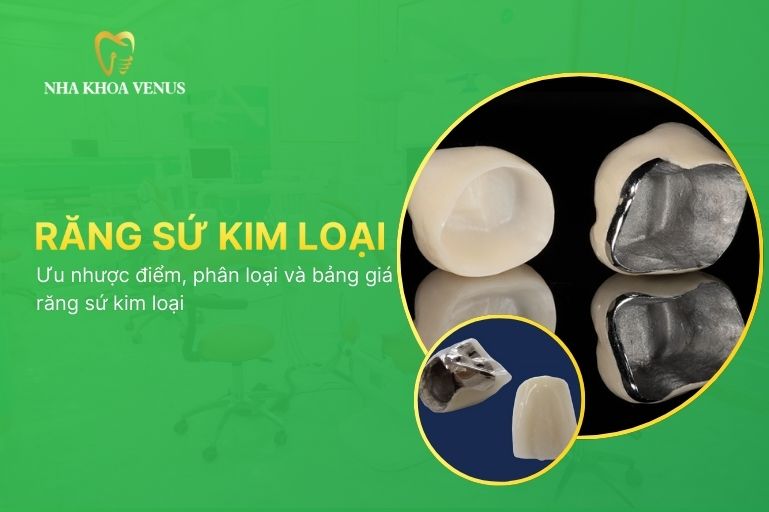 Răng sứ kim loại là gì? Ưu nhược điểm, phân loại và bảng giá răng sứ kim loại