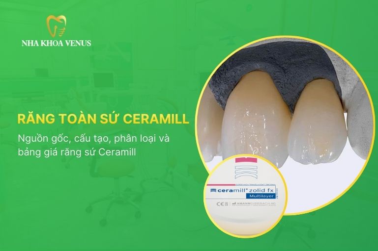 Răng toàn sứ Ceramill