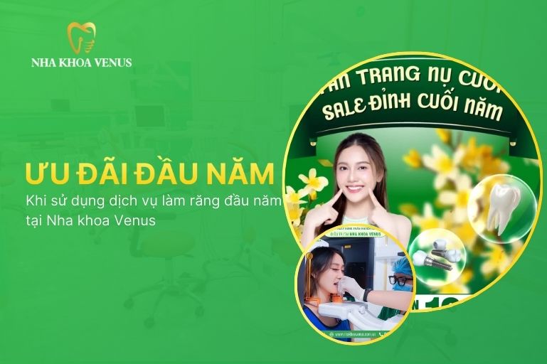 Ưu đãi khi sử dụng dịch vụ làm răng đầu năm tại Nha khoa Venus