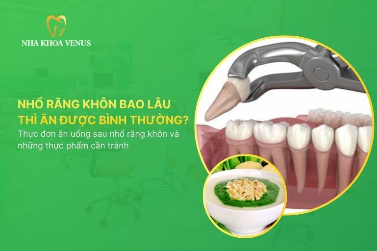 Nhổ răng khôn bao lâu thì ăn được bình thường? Thực đơn ăn uống sau nhổ răng khôn và những thực phẩm cần tránh