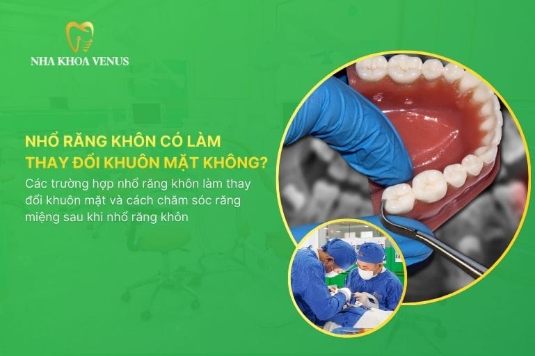 Nhổ răng khôn có làm thay đổi khuôn mặt không