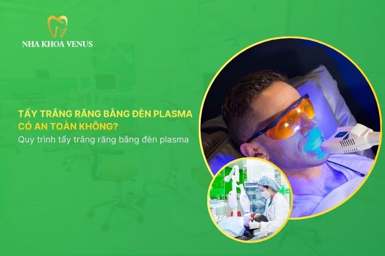 Tẩy trắng răng bằng đèn plasma là gì? Có an toàn không? Quy trình tẩy trắng răng bằng đèn plasma