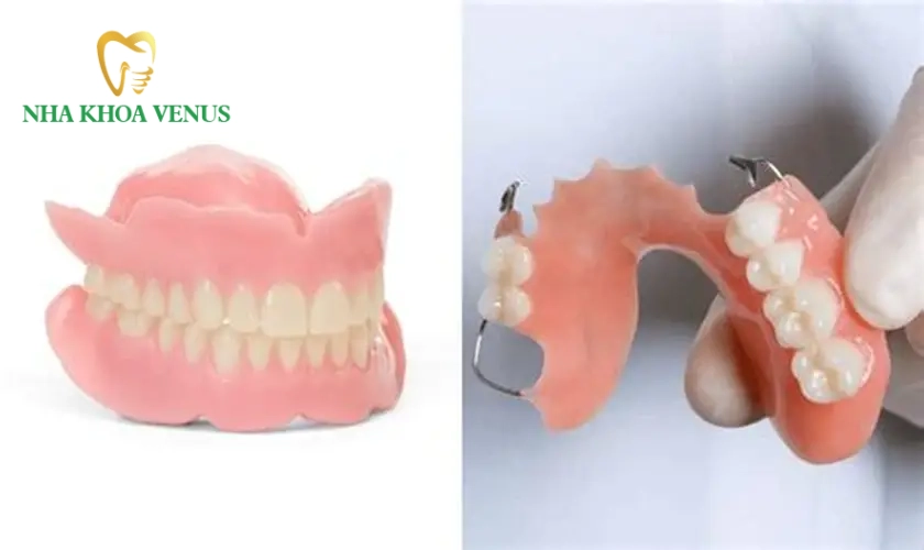 Dịch vụ phục hình răng tháo lắp Long Thành, Đồng Nai uy tín giá từ 250.000đ tại Nha Khoa Venus 10 Phục hình răng tháo lắp