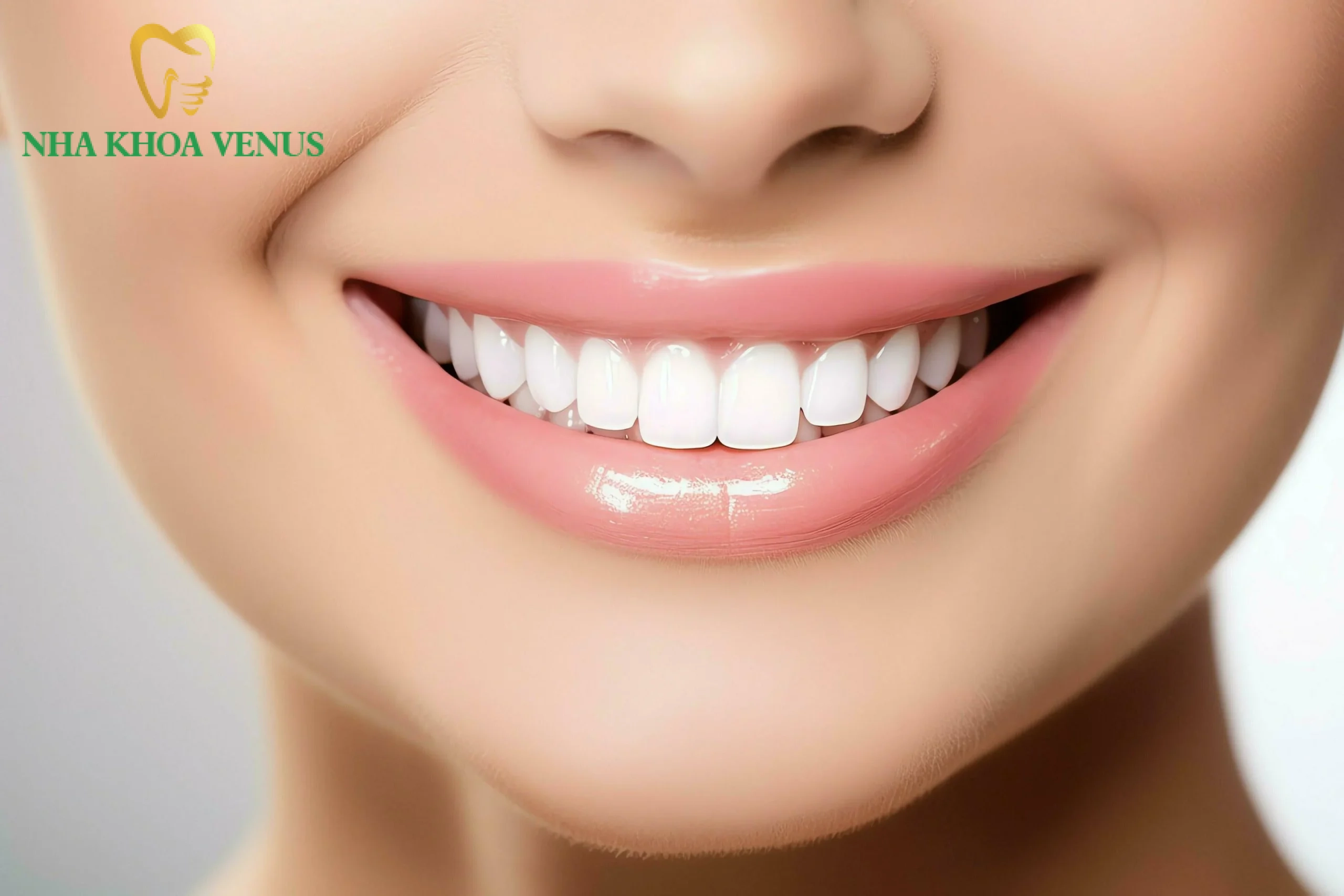 Răng sứ Venus giá bao nhiêu? Bảng giá và ưu điểm nổi bật 8 Đánh giá ưu điểm và hạn chế thực tế của răng sứ Venus