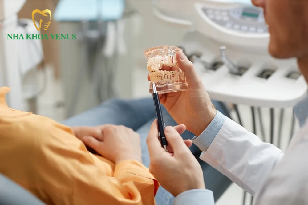Giá răng sứ Venus chính hãng bao nhiêu tiền một răng