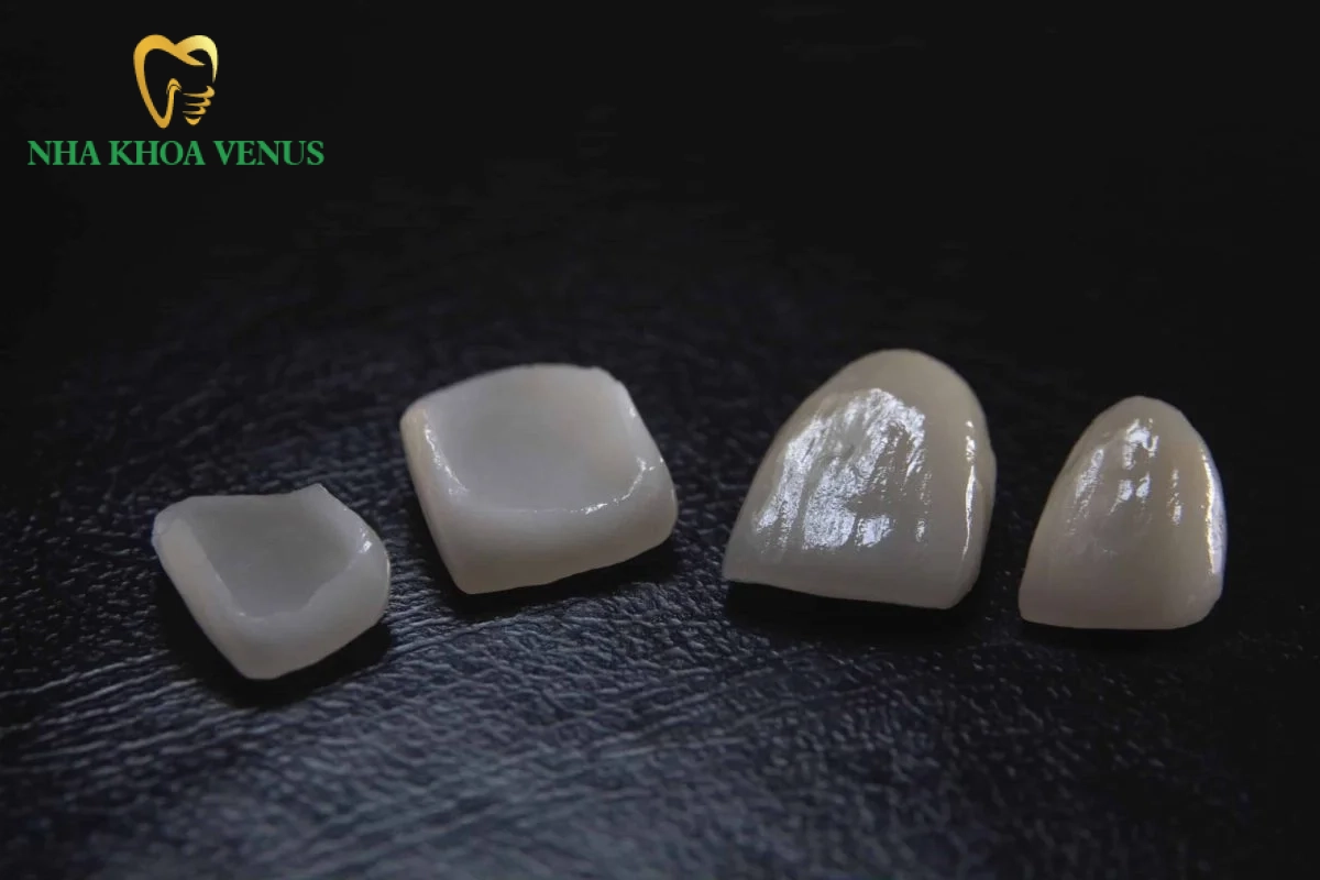 Răng sứ Lisi là gì? Ưu điểm độ bền và bảng giá trọn gói 7 Mặt dán sứ Veneer Lisi siêu mỏng từ 0.2mm bảo tồn tối đa men răng gốc và mô tủy