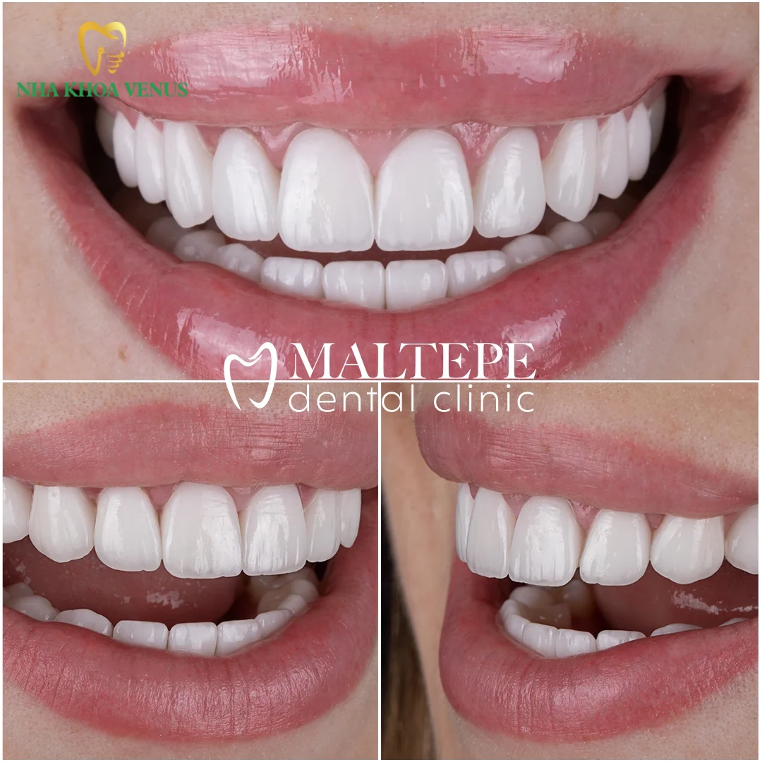 Nha khoa thẩm mỹ kiến tạo nụ cười hoàn mỹ chuẩn y khoa