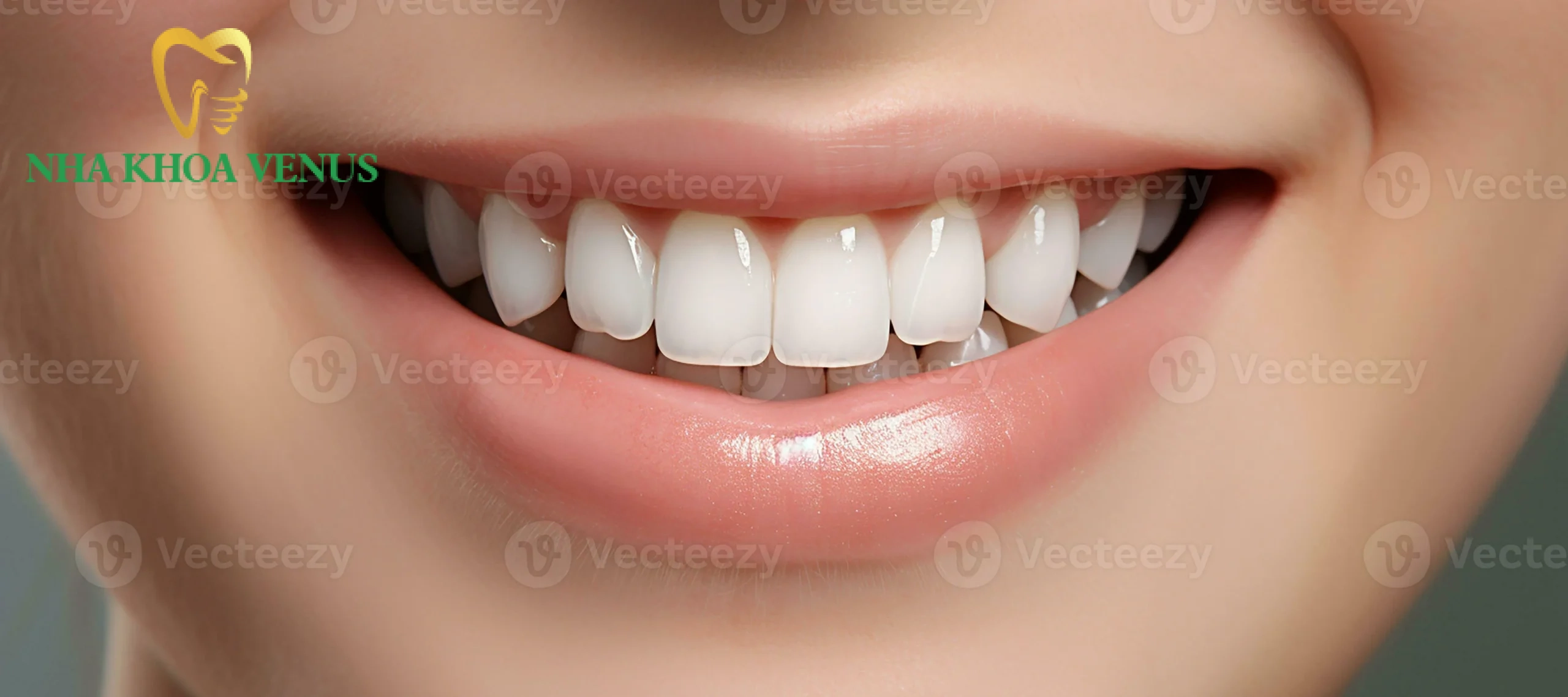 Tướng răng phú quý là gì? 6 dáng răng tài lộc may mắn 8 kết quả nụ cười trắng sáng tự nhiên và sang trọng sau khi thẩm mỹ răng sứ phong thủy