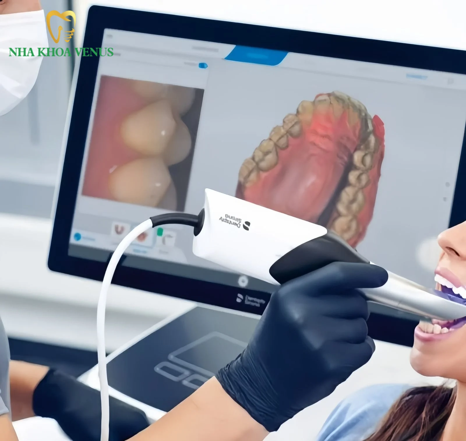 Răng sứ Venus giá bao nhiêu? Bảng giá và ưu điểm nổi bật 9 Quy trình bọc răng sứ Venus chuẩn y khoa tại Nha khoa Venus