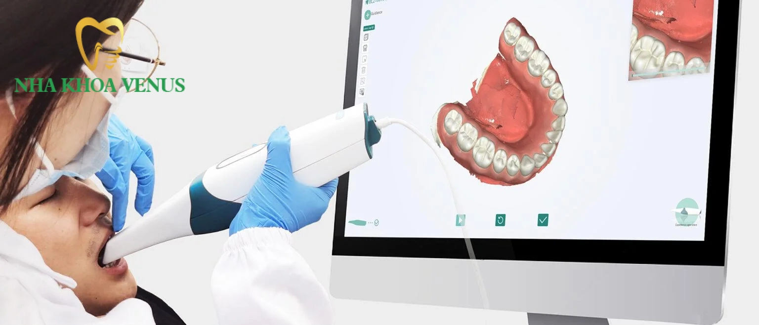 Quy trình phục hình răng sứ Lisi chuẩn y khoa tại Nha khoa Venus