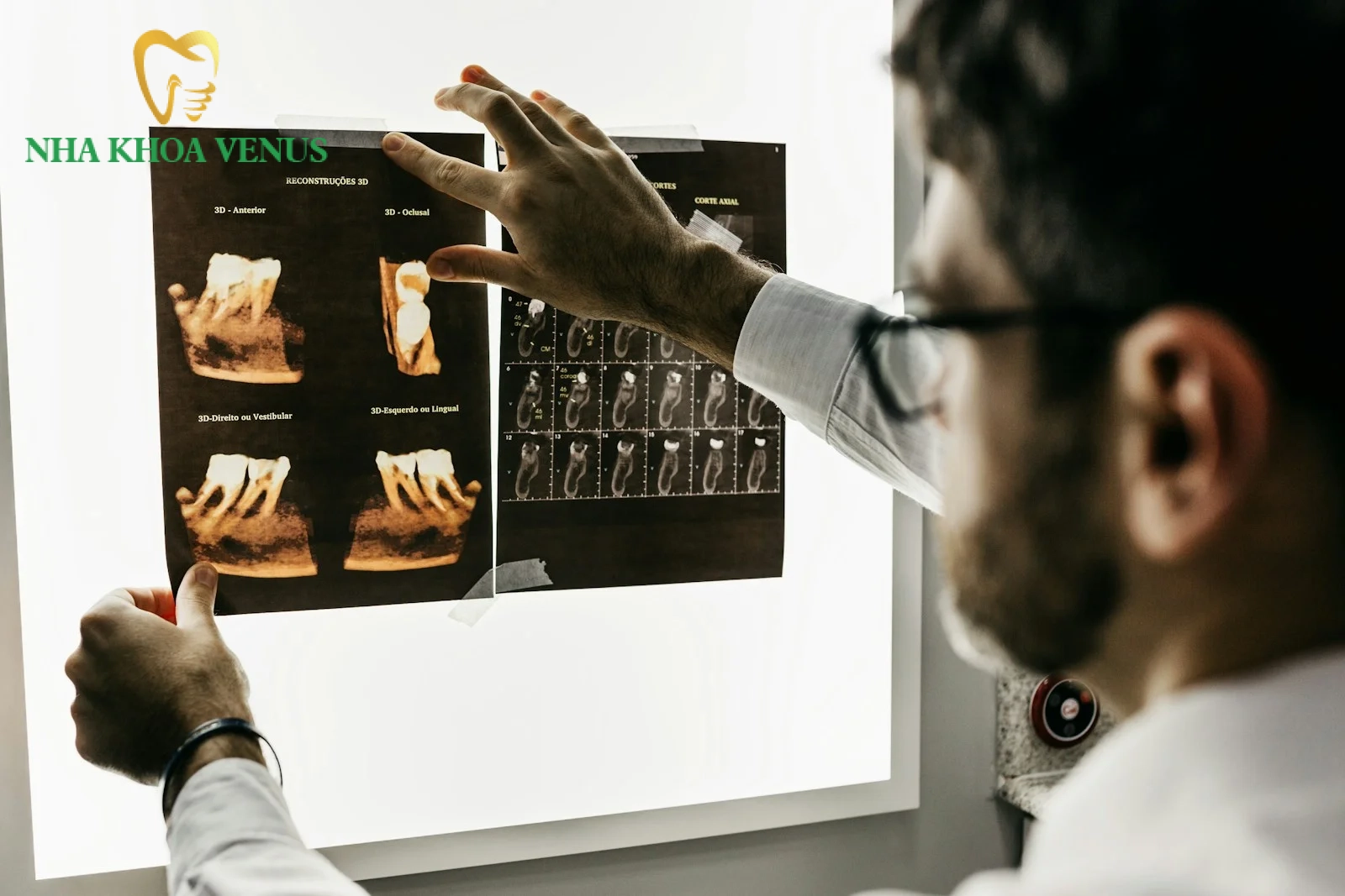 Quy trình tư vấn thẩm mỹ nụ cười toàn diện tại Nha khoa Venus
