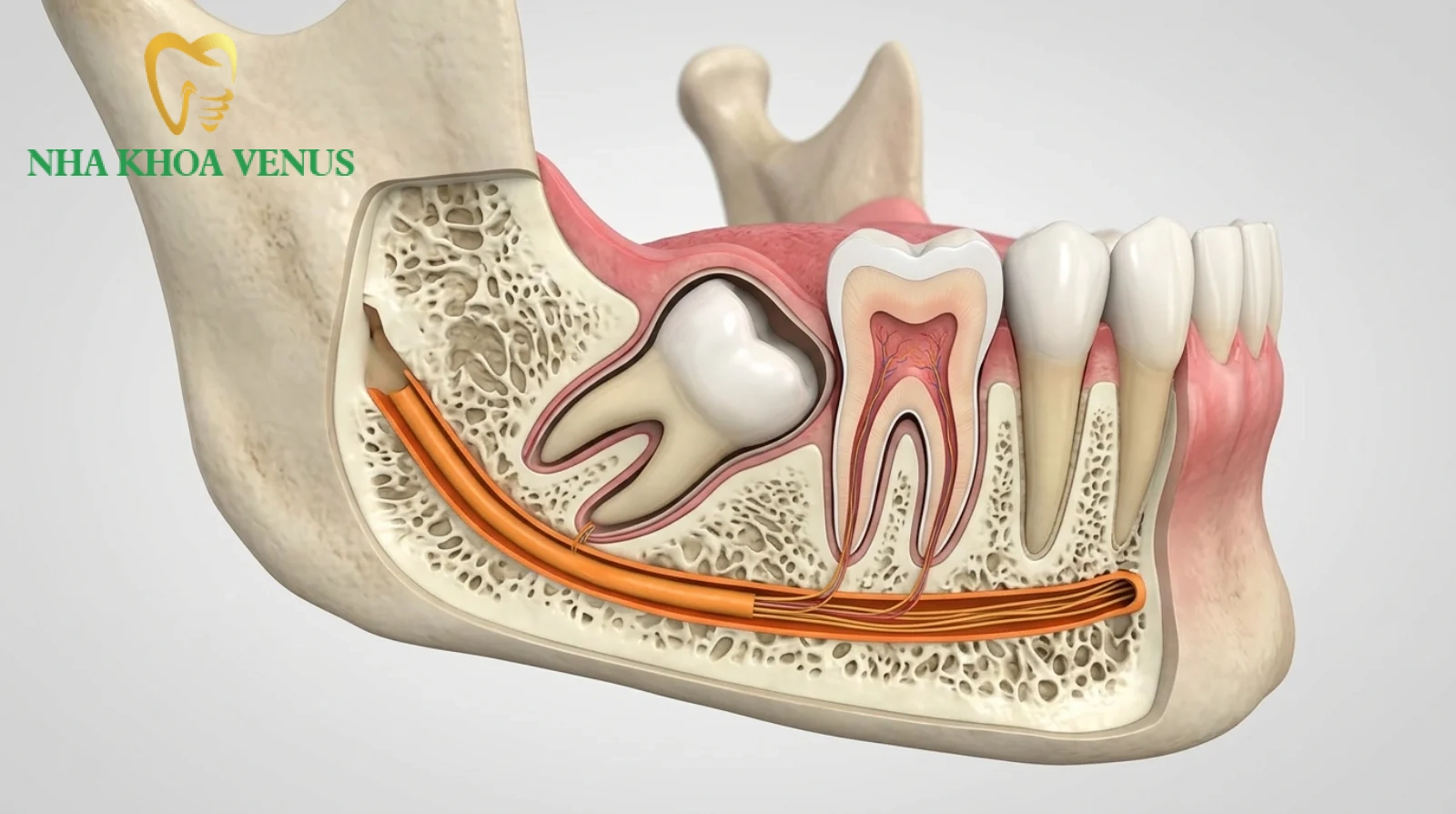 sơ đồ giải phẫu vị trí chân răng hàm lớn và ống dây thần kinh hàm dưới