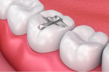 dich-vu-tram-rang (1)